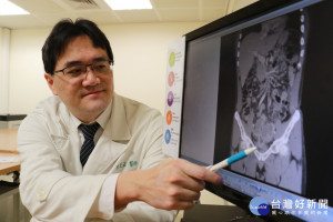 男子解尿出現排氣聲　竟是罹患大腸癌　