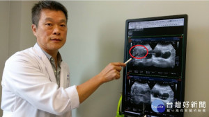 醫生指著子宮膜異位。林重鎣攝