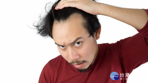 Asian man is getting bald in isolated white background.