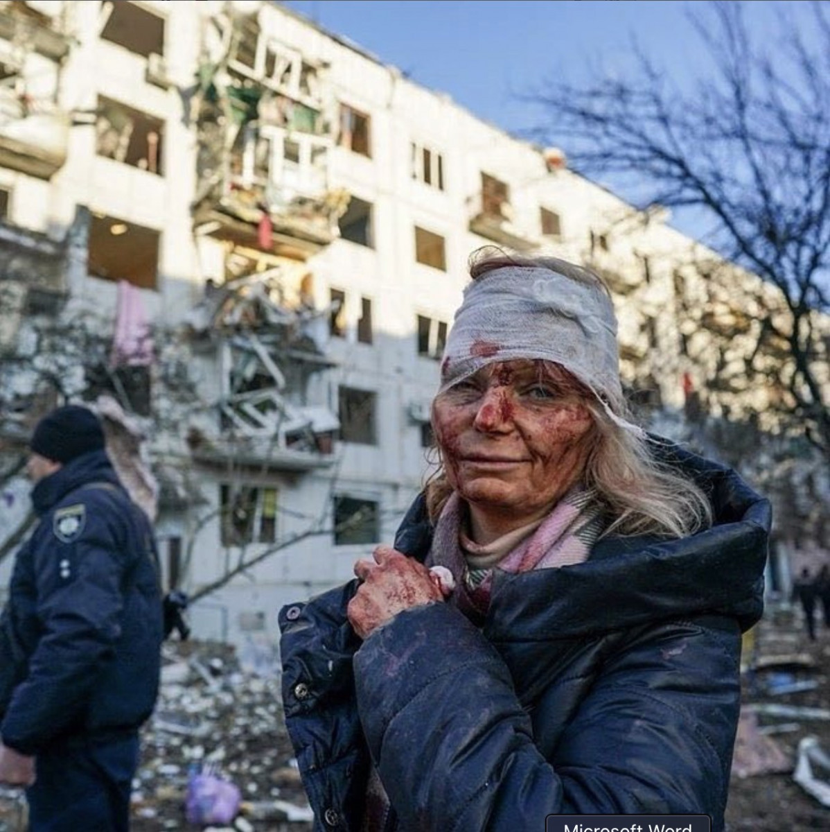 翻攝IG kharkovphotos／一名受傷的烏克蘭婦女