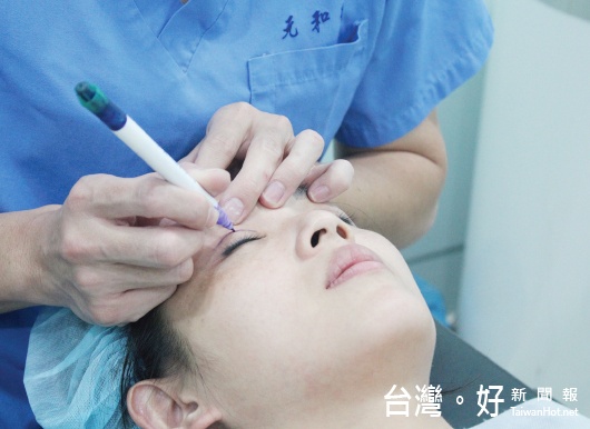 打造混血電眼　台灣雙眼皮手術享譽國際
