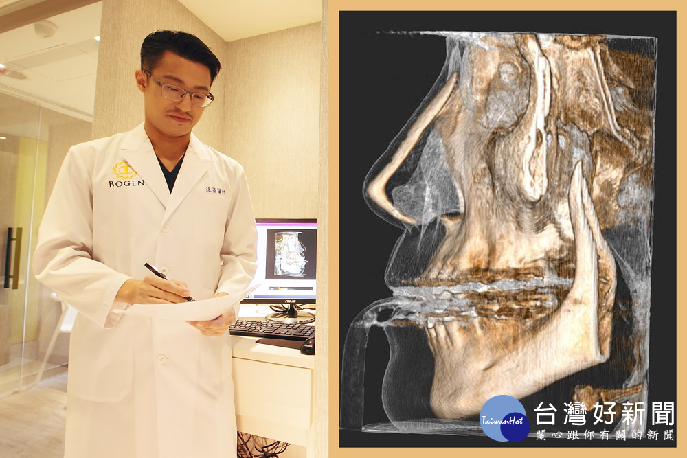 隆鼻不只能變漂亮 還可以「治鼻塞」？2