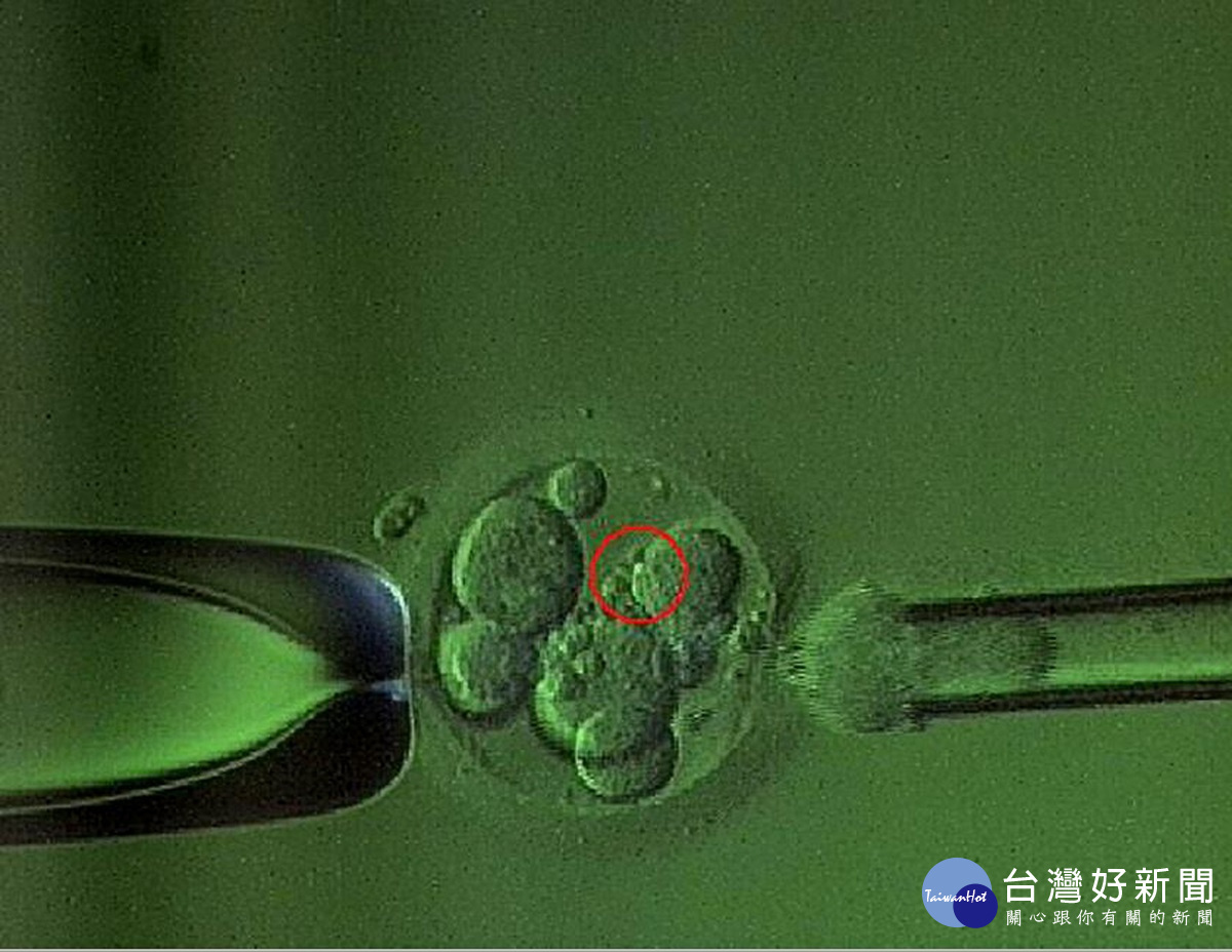 胚胎切片。圖／彰基醫院提供