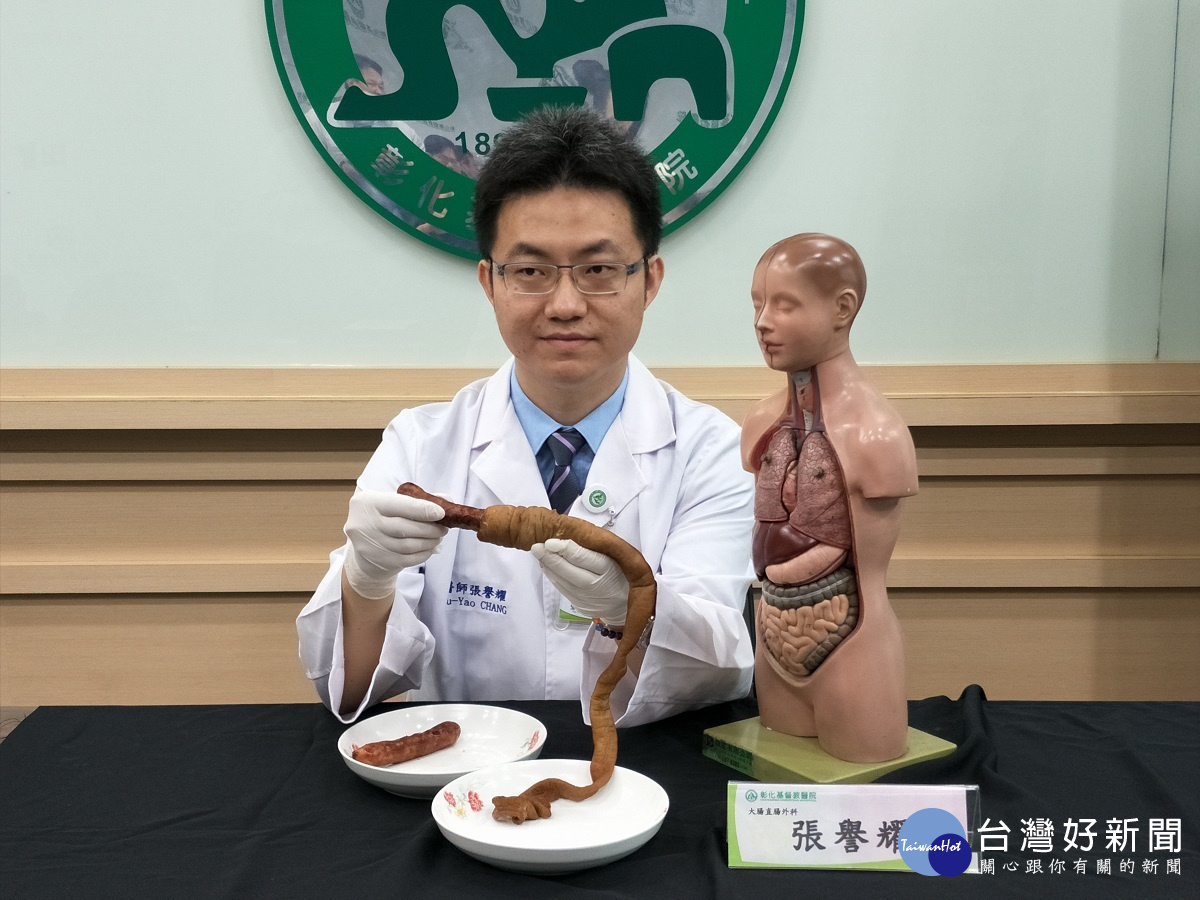 彰基醫院大腸直腸外科主治醫師張譽耀說明「腸套疊」的大腸包小腸現象。圖／記者鄧富珍攝