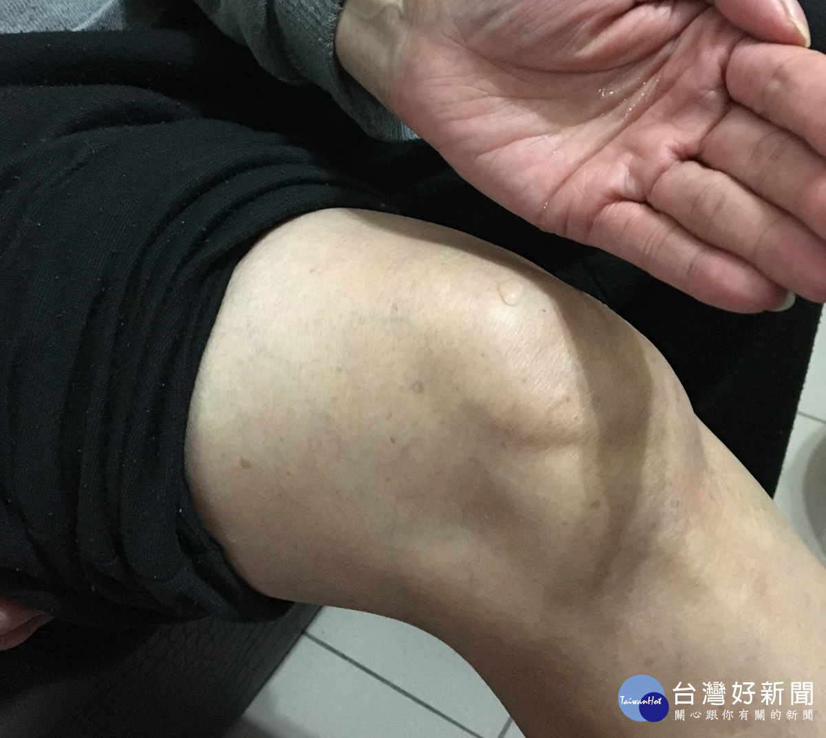 想遠離關節炎的不適,平時要勤於保養關節及適度運動。