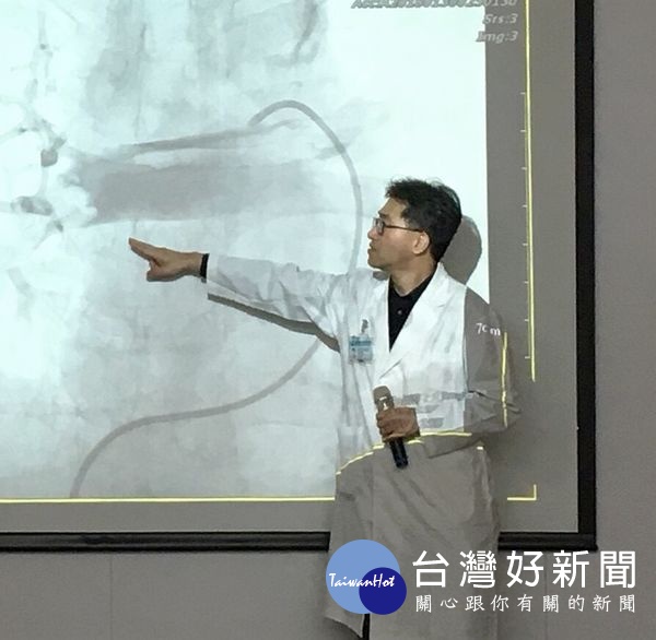 心臟內科張志斌醫師研判患者休克狀態以葉克膜輔助支持療法已來不及,選擇以豬尾巴導管將血栓攪碎。(記者陳昭宗拍攝)