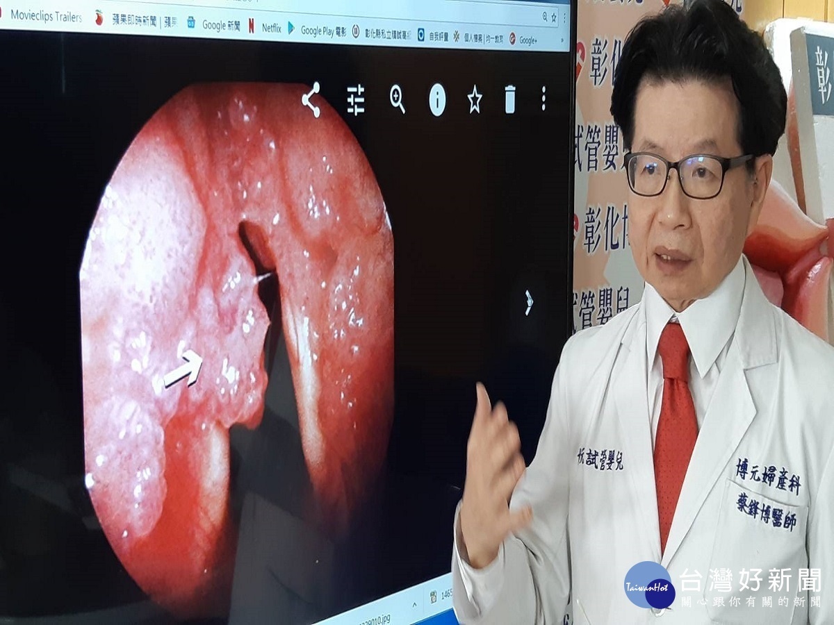 型男 玩很大 口交舌根長菜花急慌找婦產科求醫 台灣好新聞taiwanhot