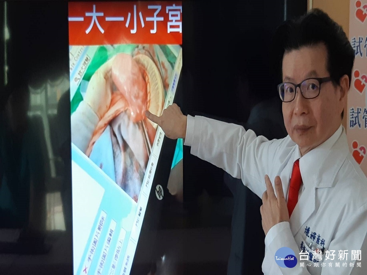 大陸女試管求子成功 剖腹時發現身帶「小三子宮」
