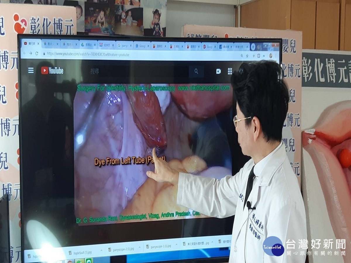 新「 Parryscope輸卵管吞氣泡測驗 」法　患者免去疼痛又快速