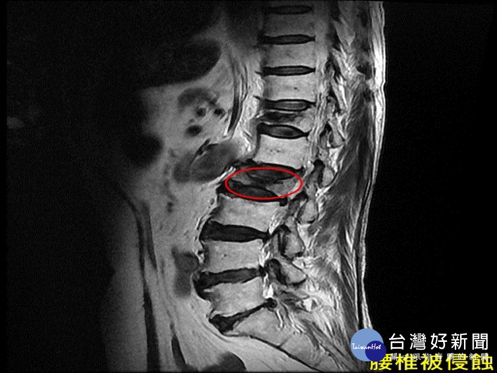 首圖