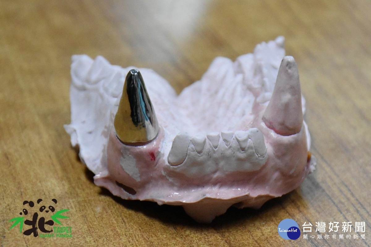 「團團」的牙套特別選用「鈦金屬」材質