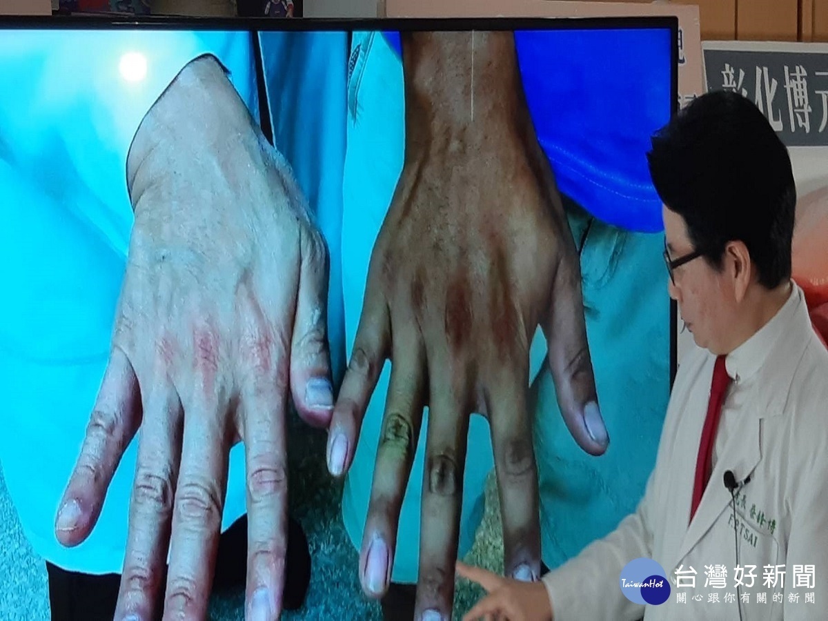 男〝大肢病〞引起不孕症 開刀后重拾生機太太自然懷孕