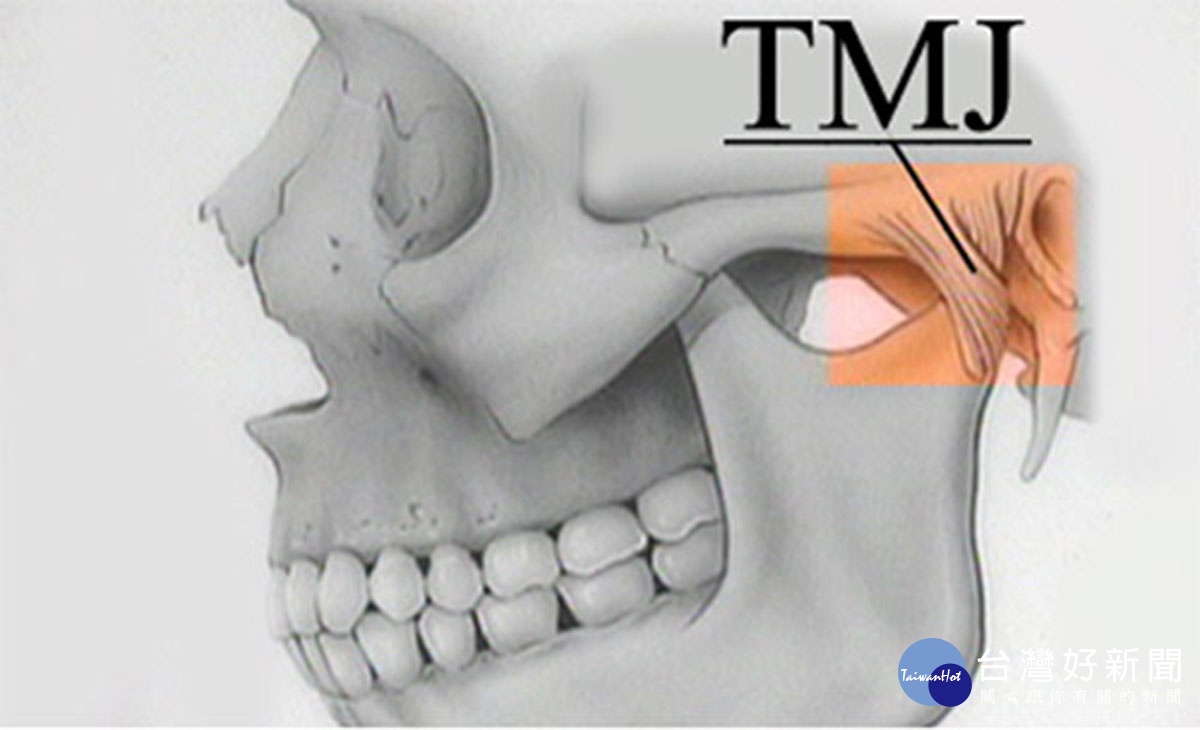 過年狂嗑零嘴要注意　小心顳顎關節障礙找上你！ 台灣好新聞 第3張