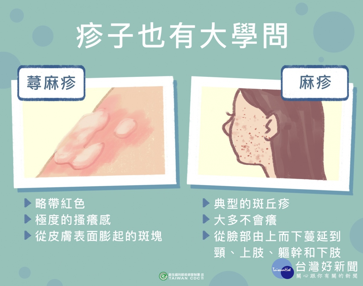 中市新增1例本土麻疹確定病例　衛生局持續追蹤224名接觸者 台灣好新聞 第1張