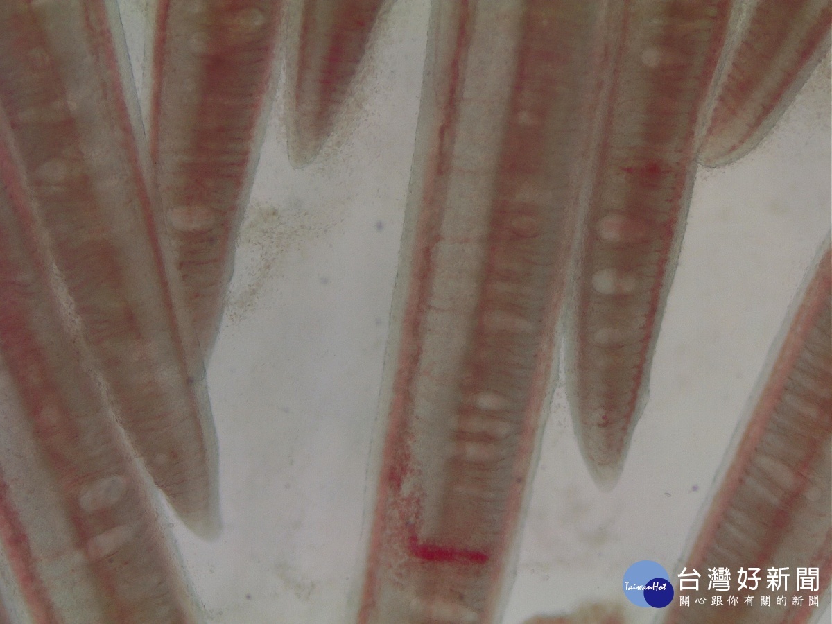 石斑魚感染上皮囊腫病，鰓上皮細胞呈現囊狀腫大。
