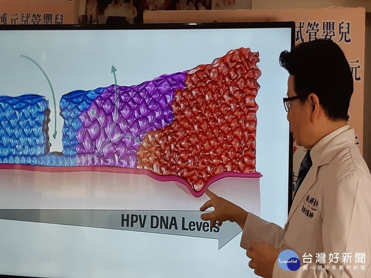 老翁性生活玩很大　口染性病求醫雷射打疫苗 台灣好新聞 第1張