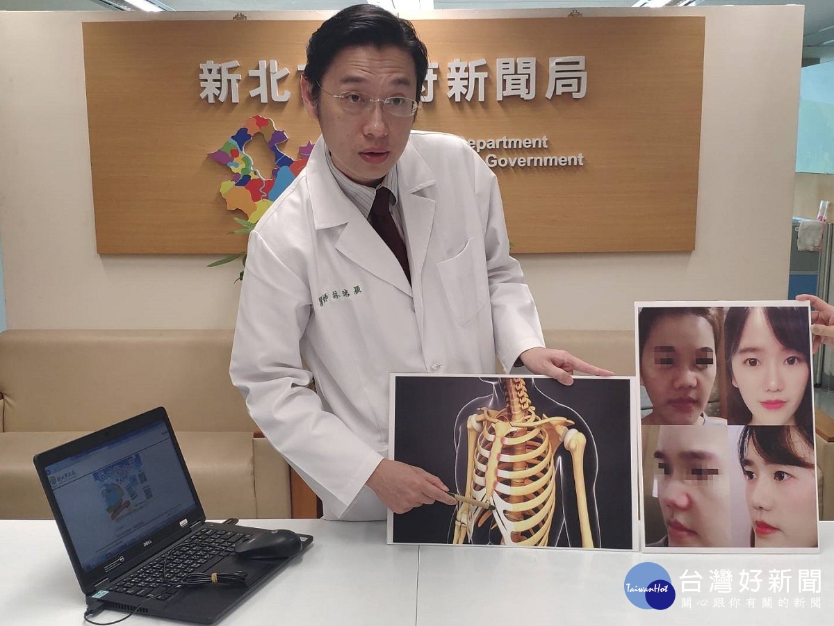 女子車禍鼻腔扭曲變形赴聯醫求診　肋軟骨重建找回自信 台灣好新聞 第2張