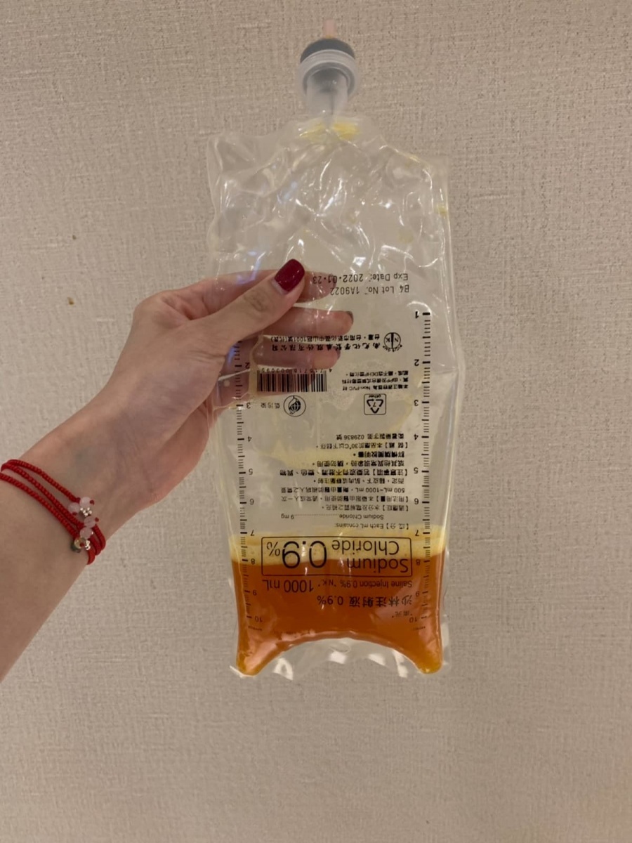 此為洗出來的廢棄物,橘色代表壞膽固醇過高。(圖/海亞大健康管理診所提供)