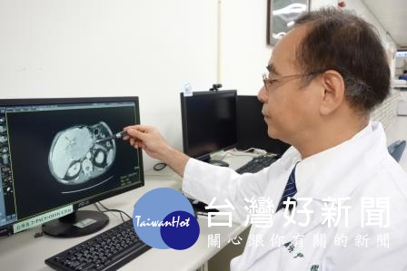 8旬老翁腫瘤大如另一顆肝臟 醫師妙手切除救命 台灣好新聞 第1張-尋夢好新聞 8旬老翁腫瘤大如另一顆肝臟 醫師妙手切除救命 台灣好新聞 第1張