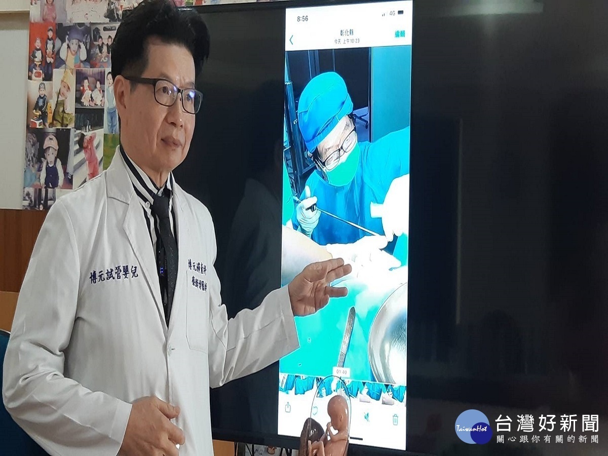 女外陰腫如高爾夫球 醫師手術瞬間爆漿原是巴氏腺囊腫惹禍