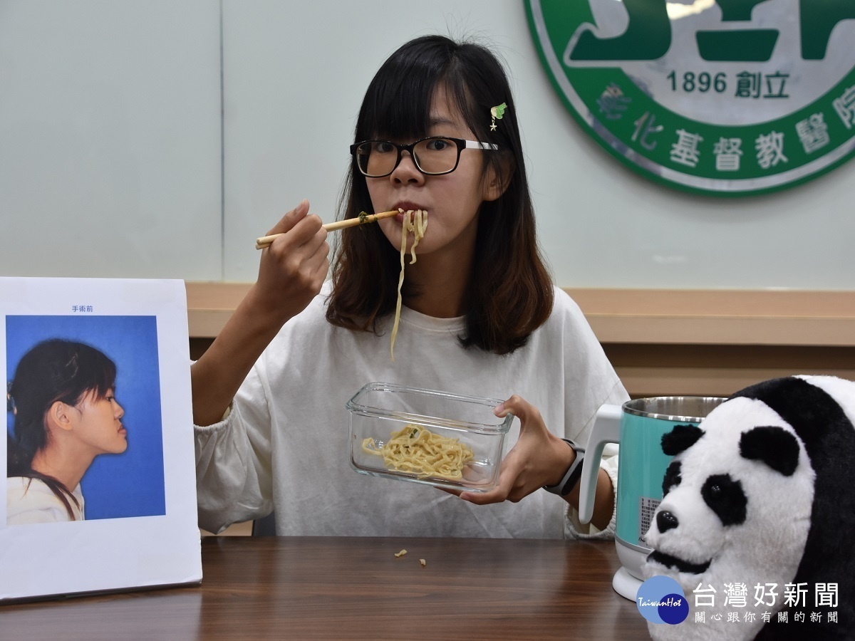 少女嚴重戽斗顏面歪斜 彰基3D技術重拾嶄新面貌與心情