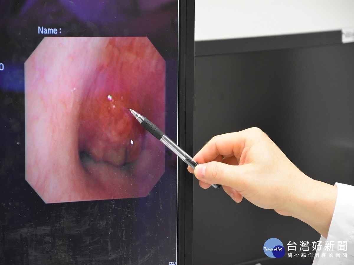 過度擔憂疫情怕就醫 癌婦鬼門關前走一遭