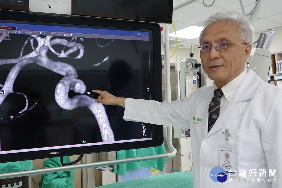 陳啟仁教授指出葉姓婦人右側的動脈瘤未破裂，進行微創動脈瘤栓塞手術。