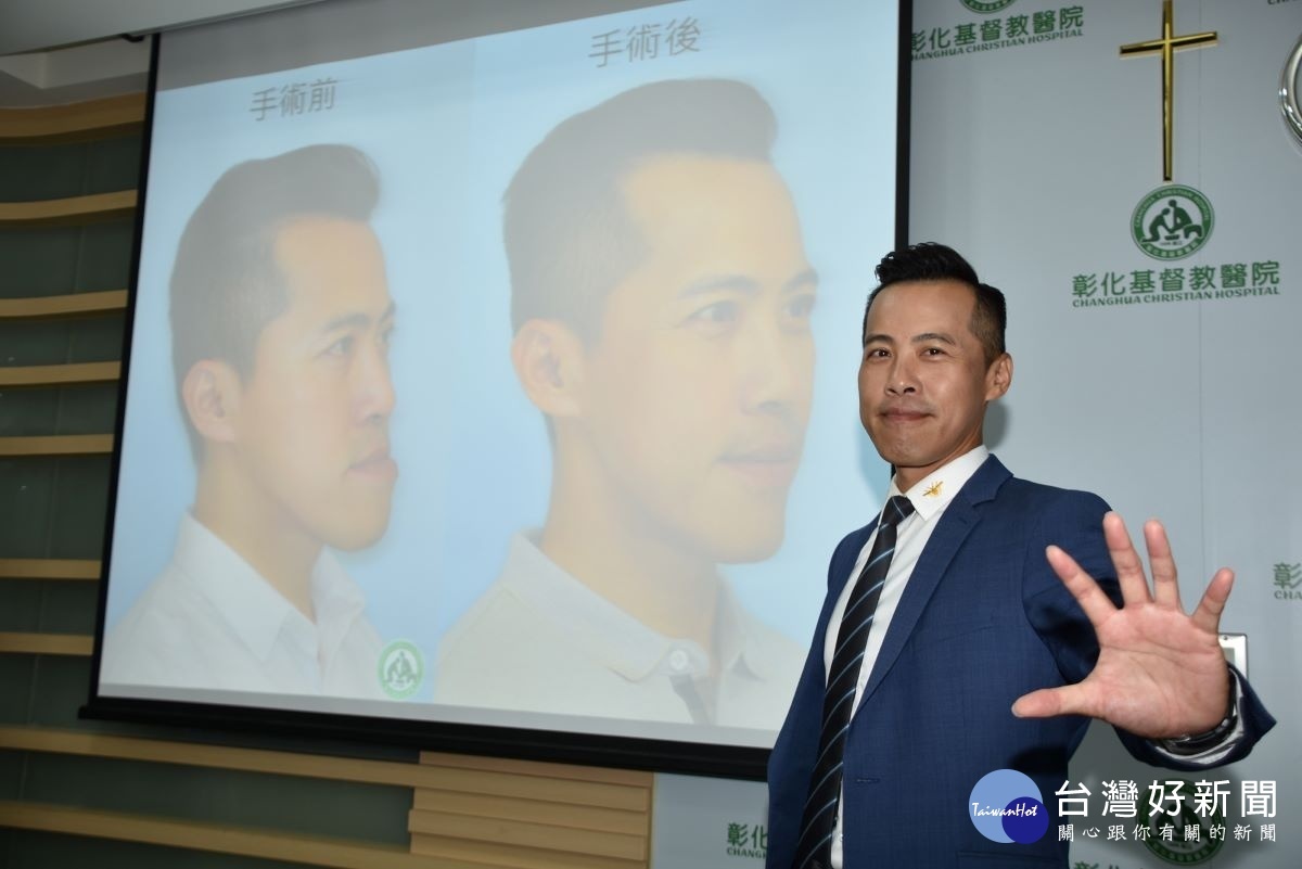 張庭維接受3D列印輔助正顎手術，身體不但恢復健康，更從「戽斗帝王」變身「型男總裁」。