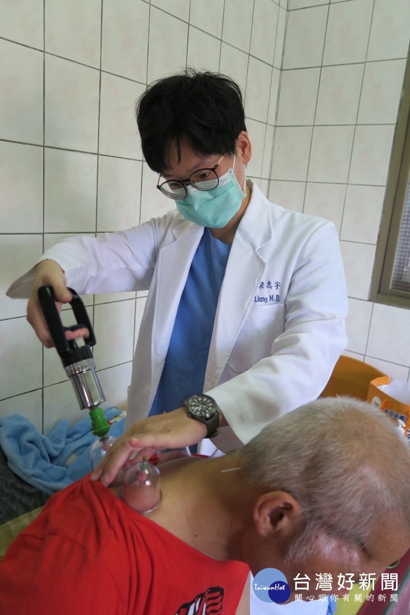 梁惠宇中醫師針灸拔罐畫面。圖／彰化醫院提供