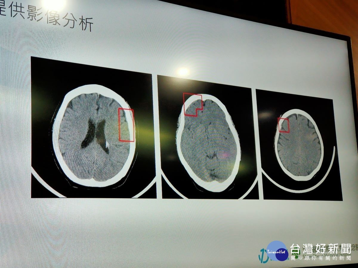 秀傳醫院導入智慧系統，減少腦出血病人急診停留時間的重要關鍵。圖／記者鄧富珍攝