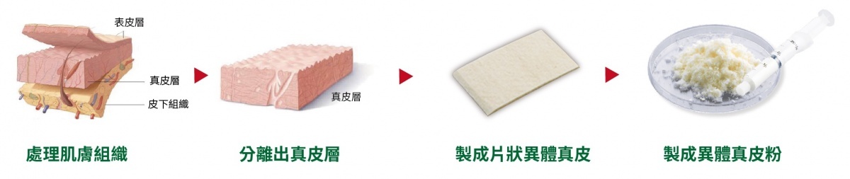 異體真皮粉由肌膚真皮層組織經由特殊製程所產生,是新型態的微整填充產品。(圖/粹究美學診所提供)