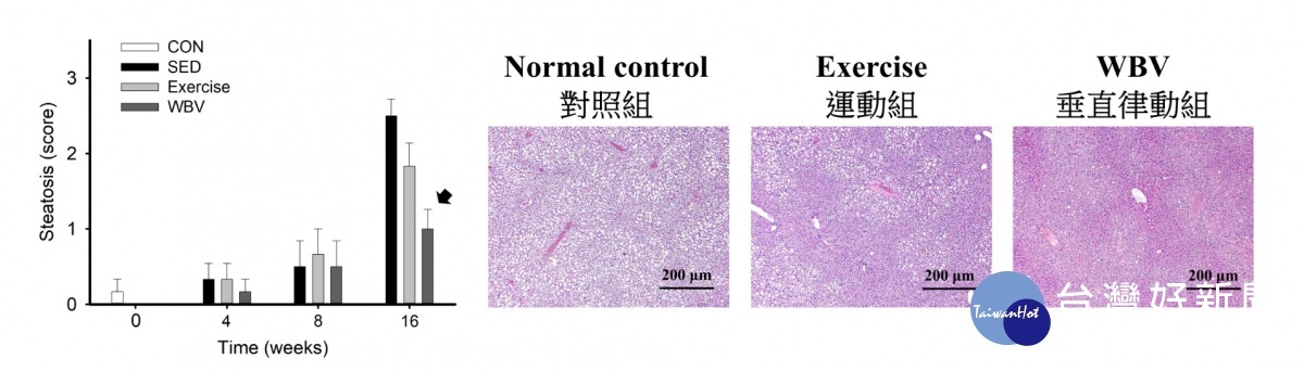 懶人運動法有望改善脂肪肝!? 長庚大學超音波研究新發現